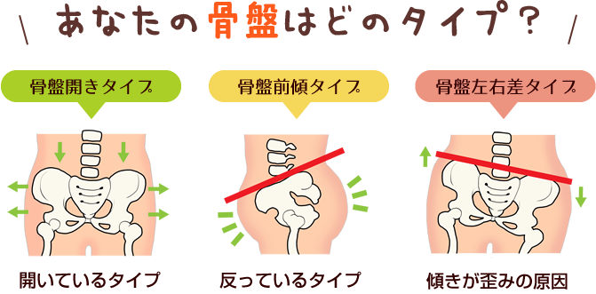 骨盤のタイプ
